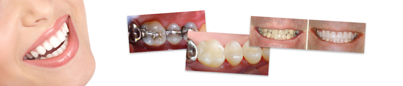 Silvestri & Comfort Family Dentistry