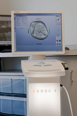CEREC